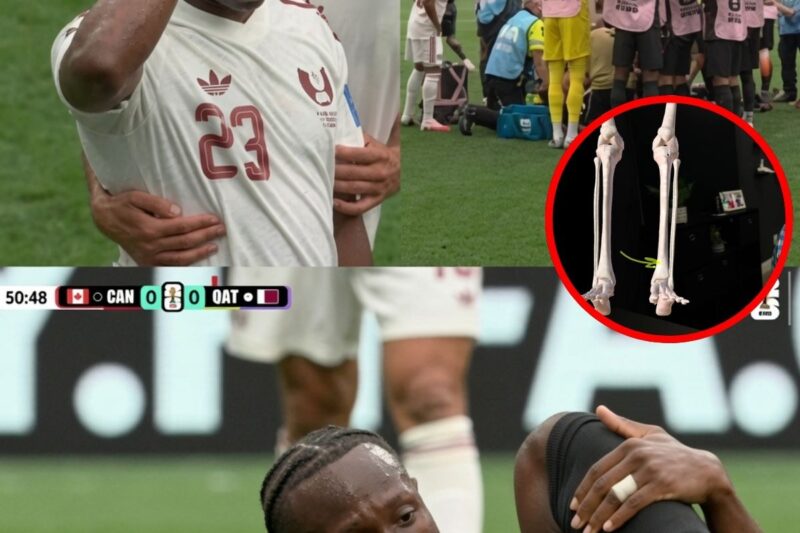 The Heartbreak on the Pitch: Understanding Ismaël Koné’s Devastating Injury