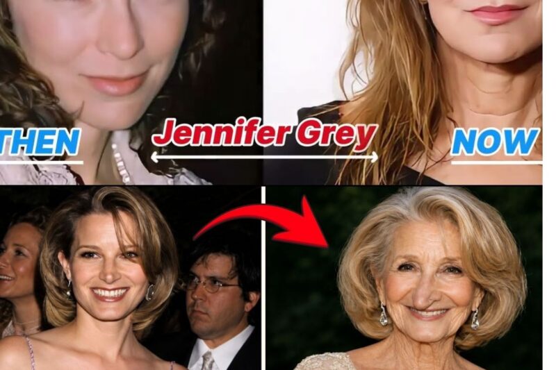 16 Beautiful Hollywood Actresses Ruined by Plastic Surgery