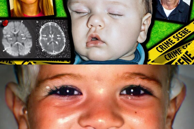 This Child Had 23 Of Worst Brain Injuries Ever